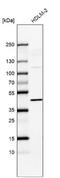 Interleukin 13 Receptor Subunit Alpha 1 antibody, NBP2-55120, Novus Biologicals, Western Blot image 