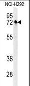 Kelch Like Family Member 24 antibody, LS-C165572, Lifespan Biosciences, Western Blot image 