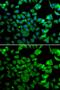 N(Alpha)-Acetyltransferase 10, NatA Catalytic Subunit antibody, GTX64704, GeneTex, Immunocytochemistry image 