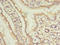 Tripartite Motif Containing 15 antibody, LS-C380098, Lifespan Biosciences, Immunohistochemistry paraffin image 