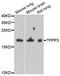 Tubulin polymerization-promoting protein family member 3 antibody, A6775, ABclonal Technology, Western Blot image 