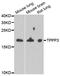 Tubulin Polymerization Promoting Protein Family Member 3 antibody, A6775, ABclonal Technology, Western Blot image 