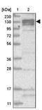 ATPase Phospholipid Transporting 11B (Putative) antibody, NBP1-88900, Novus Biologicals, Western Blot image 