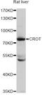 Carnitine O-Octanoyltransferase antibody, A4790, ABclonal Technology, Western Blot image 