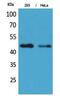 Isocitrate Dehydrogenase (NADP(+)) 1, Cytosolic antibody, A00129, Boster Biological Technology, Western Blot image 