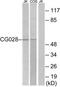 Vacuolar fusion protein CCZ1 homolog B antibody, TA316260, Origene, Western Blot image 