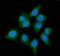 Alcohol Dehydrogenase 1A (Class I), Alpha Polypeptide antibody, PB10029, Boster Biological Technology, Immunofluorescence image 