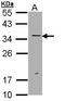 ERCC Excision Repair 1, Endonuclease Non-Catalytic Subunit antibody, LS-C109357, Lifespan Biosciences, Western Blot image 