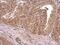 Insulin Receptor antibody, PA5-27334, Invitrogen Antibodies, Immunohistochemistry paraffin image 