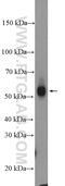Alpha-L-Fucosidase 1 antibody, 16420-1-AP, Proteintech Group, Western Blot image 