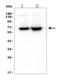 CD5 Molecule antibody, M00480-2, Boster Biological Technology, Western Blot image 