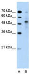 Tripartite Motif Containing 59 antibody, TA330524, Origene, Western Blot image 