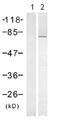 Protein Kinase C Beta antibody, ab75657, Abcam, Western Blot image 