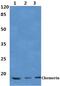 Retinoic Acid Receptor Responder 2 antibody, PA5-75669, Invitrogen Antibodies, Western Blot image 