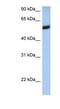 Major Histocompatibility Complex, Class I, F antibody, NBP1-59537, Novus Biologicals, Western Blot image 