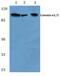 Catenin Alpha 1 antibody, PA5-36046, Invitrogen Antibodies, Western Blot image 