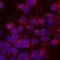 Unc-5 Netrin Receptor A antibody, AF1405, R&D Systems, Immunocytochemistry image 