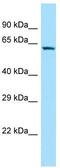 Sosondowah Ankyrin Repeat Domain Family Member C antibody, TA331763, Origene, Western Blot image 