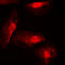 Interferon Regulatory Factor 4 antibody, LS-C354012, Lifespan Biosciences, Immunofluorescence image 