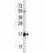 Hemoglobin Subunit Theta 1 antibody, F42634-0.4ML, NSJ Bioreagents, Western Blot image 