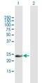 Inverted Formin, FH2 And WH2 Domain Containing antibody, H00064423-B02P, Novus Biologicals, Western Blot image 