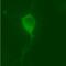Leucine Rich Repeat Kinase 2 antibody, PA1-16770, Invitrogen Antibodies, Immunocytochemistry image 