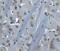 Bruton Tyrosine Kinase antibody, 3395, ProSci, Immunohistochemistry paraffin image 