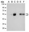 Carbonic Anhydrase 9 antibody, GTX70020, GeneTex, Western Blot image 