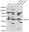 Zinc Finger And BTB Domain Containing 25 antibody, 22-988, ProSci, Western Blot image 
