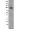 p99 antibody, abx148939, Abbexa, Western Blot image 