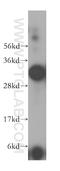 Lactamase Beta 2 antibody, 16783-1-AP, Proteintech Group, Western Blot image 