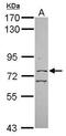 CXXC Finger Protein 1 antibody, GTX116104, GeneTex, Western Blot image 