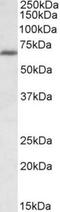 IKAROS Family Zinc Finger 1 antibody, NBP1-51990, Novus Biologicals, Western Blot image 