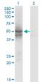 Isocitrate Dehydrogenase (NADP(+)) 2, Mitochondrial antibody, H00003418-M01, Novus Biologicals, Western Blot image 