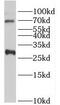 Immediate-early protein CL-6 antibody, FNab04333, FineTest, Western Blot image 