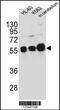 Calcium/Calmodulin Dependent Protein Kinase IG antibody, MBS9210076, MyBioSource, Western Blot image 