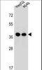 ER Lipid Raft Associated 1 antibody, LS-C167810, Lifespan Biosciences, Western Blot image 