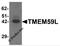 Transmembrane Protein 59 Like antibody, 6435, ProSci, Western Blot image 