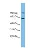 Ankyrin Repeat And EF-Hand Domain Containing 1 antibody, NBP1-56444, Novus Biologicals, Western Blot image 