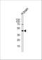 5-Hydroxytryptamine Receptor 1A antibody, A01467-1, Boster Biological Technology, Western Blot image 