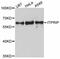 Inositol 1,4,5-Trisphosphate Receptor Interacting Protein antibody, PA5-76541, Invitrogen Antibodies, Western Blot image 
