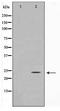 TIMP Metallopeptidase Inhibitor 3 antibody, TA347482, Origene, Western Blot image 