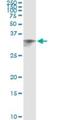 Cell Death Inducing DFFA Like Effector A antibody, H00001149-M01, Novus Biologicals, Immunoprecipitation image 
