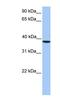 Casein Kinase 2 Alpha 1 antibody, NBP1-56402, Novus Biologicals, Western Blot image 