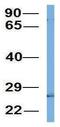 Complement Component 4 Binding Protein Beta antibody, GTX47750, GeneTex, Western Blot image 