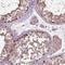 PEAK1 Related, Kinase-Activating Pseudokinase 1 antibody, HPA012066, Atlas Antibodies, Immunohistochemistry frozen image 