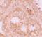 WD Repeat Domain 92 antibody, PA5-21012, Invitrogen Antibodies, Immunohistochemistry paraffin image 