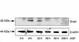 Snail Family Transcriptional Repressor 1 antibody, F47913-0.4ML, NSJ Bioreagents, Immunohistochemistry paraffin image 