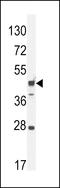 Rab Interacting Lysosomal Protein Like 1 antibody, LS-C162605, Lifespan Biosciences, Western Blot image 