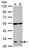 Growth Hormone Secretagogue Receptor antibody, PA5-28752, Invitrogen Antibodies, Western Blot image 